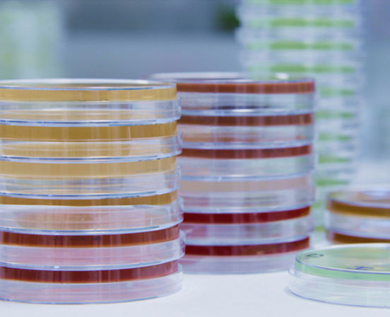 Various Agar Plates
