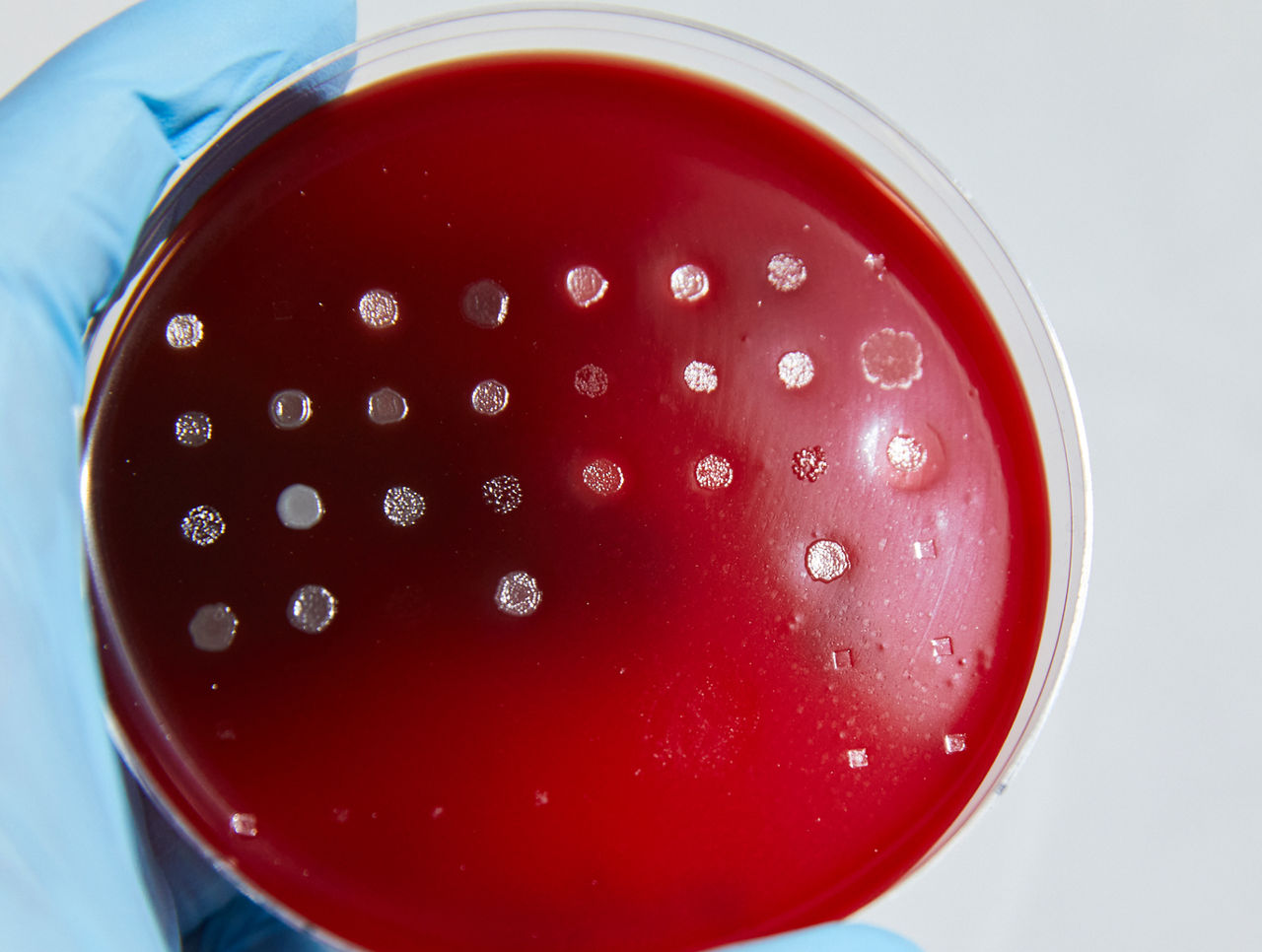  Close up of red agar plate showing QC testing results for various bacteria