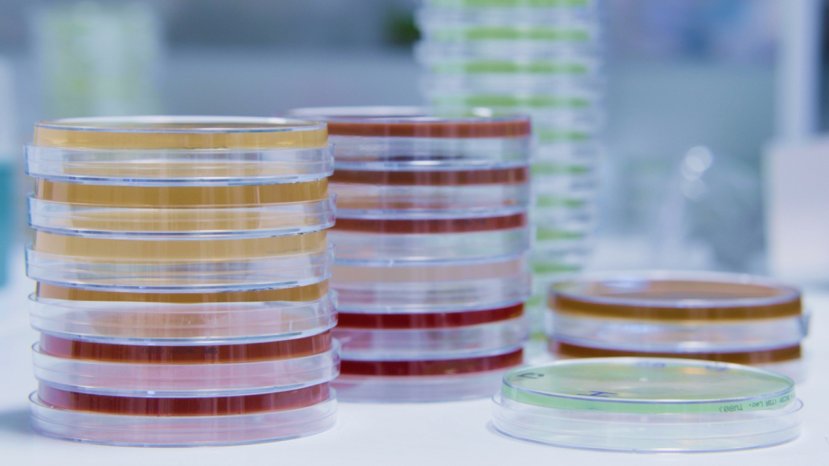 Agar plates in various colors