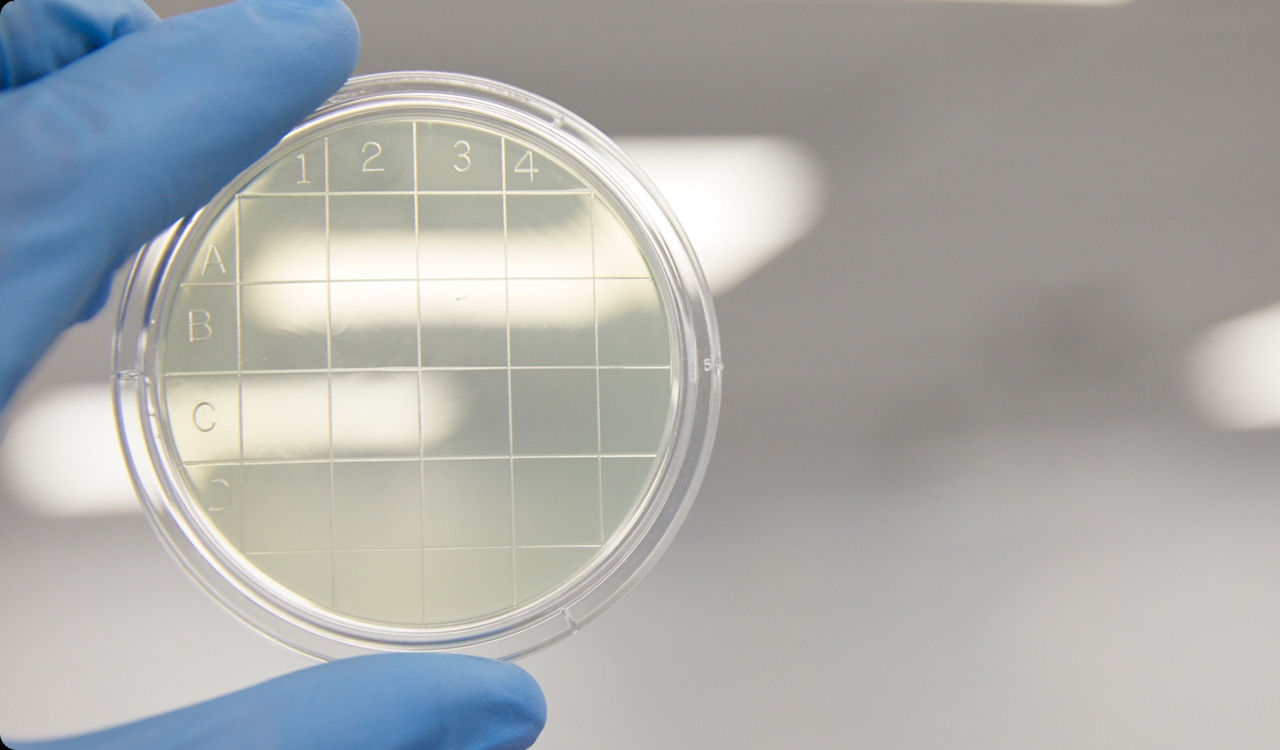 Close up of gloved hand holding gridded contact plate up to the light